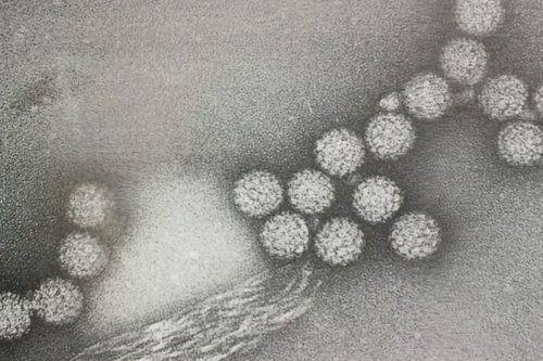 HPVウイルス